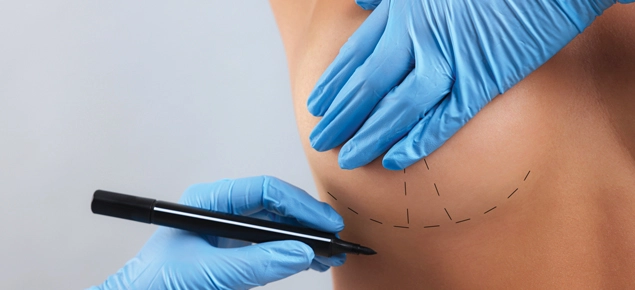 breast-lift-procedure-dr-schmitt-plastic-surgery-portland-oregon